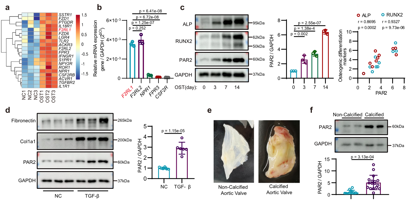 NC文章：磁性纳米颗粒靶向给药缓解瓣膜钙化-香草杏仁