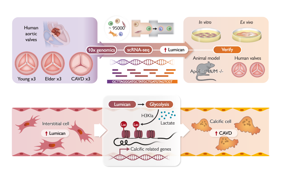 EHJ：Lumican通过H3组蛋白乳酸化促进CAVD-香草杏仁