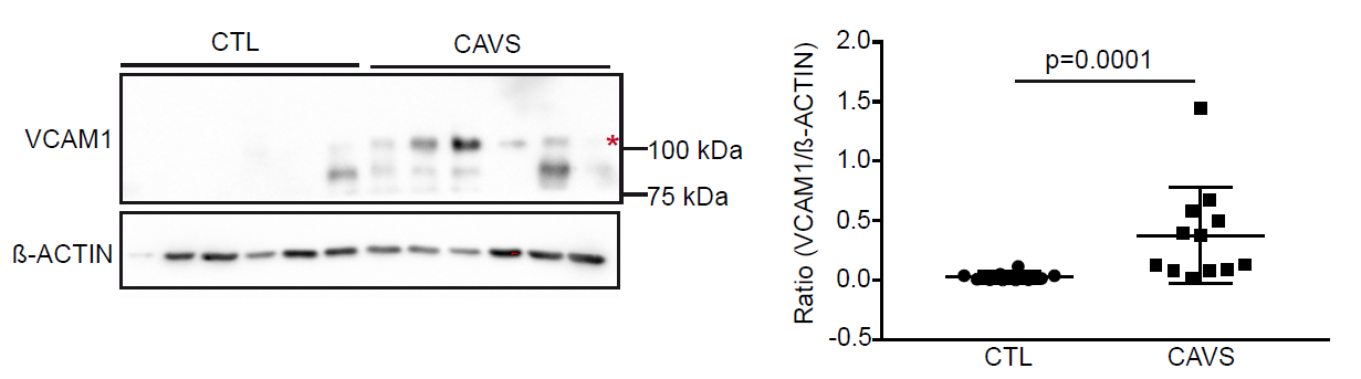 Activated%20platelets%20promote%20an%20osteogenic%20programm%20255b6a1b03bc4734b13a4e94a7841018/Untitled%202.png