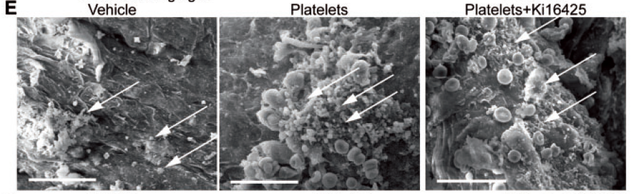 Activated%20platelets%20promote%20an%20osteogenic%20programm%20255b6a1b03bc4734b13a4e94a7841018/Untitled%2030.png