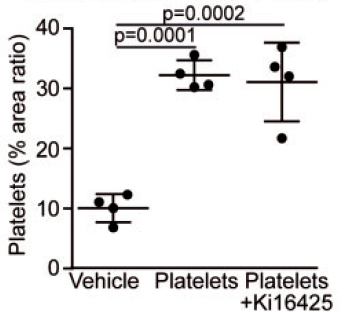 Activated%20platelets%20promote%20an%20osteogenic%20programm%20255b6a1b03bc4734b13a4e94a7841018/Untitled%2031.png