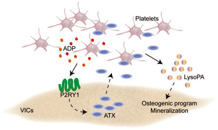 EHJ：活化的血小板促进成骨并推动钙化性主动脉瓣狭窄的进展-香草杏仁
