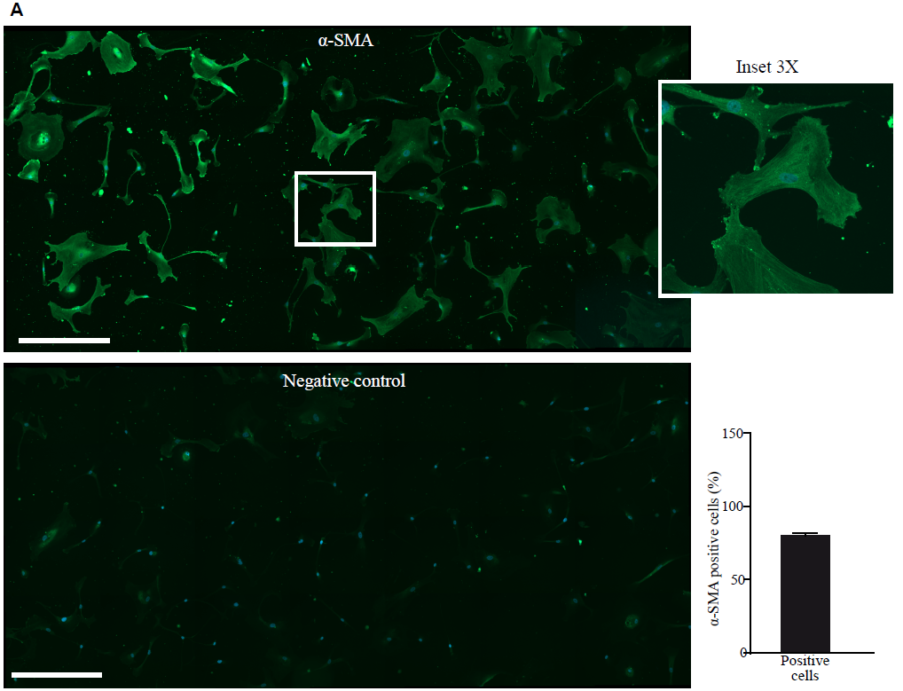 Activated%20platelets%20promote%20an%20osteogenic%20programm%20255b6a1b03bc4734b13a4e94a7841018/Untitled%205.png