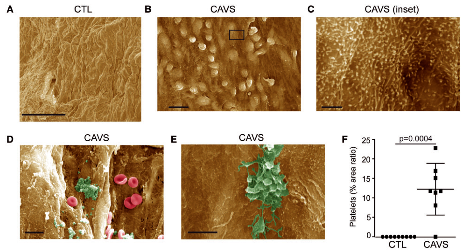 Activated%20platelets%20promote%20an%20osteogenic%20programm%20255b6a1b03bc4734b13a4e94a7841018/Untitled%201.png