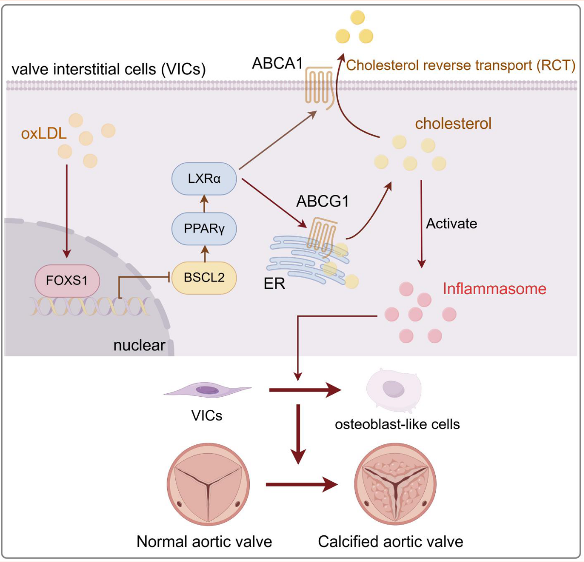 CVR：FOXS1介导胆固醇转运失调驱动主动脉瓣钙化研究-香草杏仁