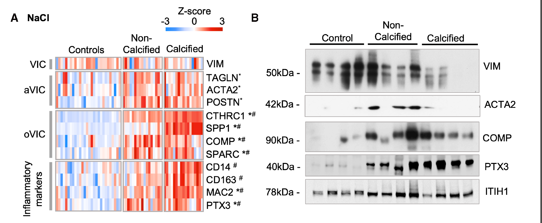 Figure 4A–B:人瓣膜细胞状态相关蛋白及 Western blot