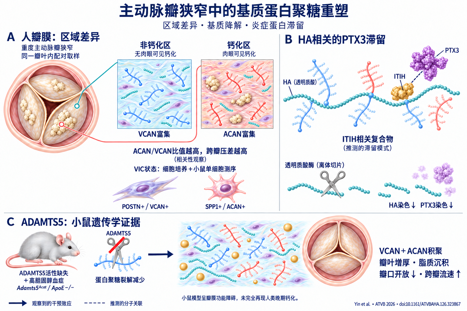 ATVB:主动脉瓣狭窄中的透明质酸结合蛋白聚糖重塑-香草杏仁