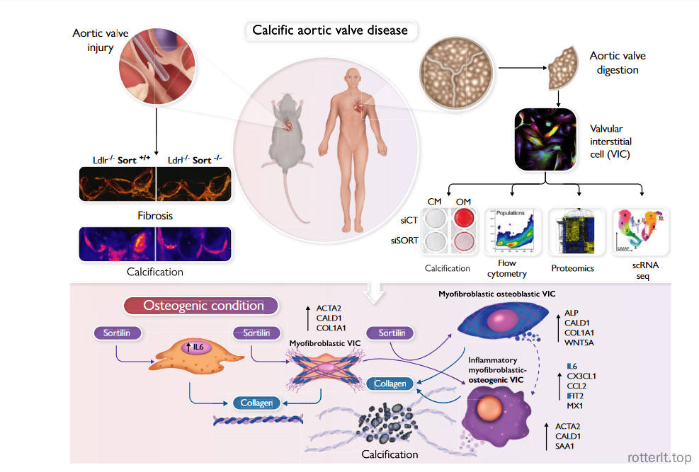 Sortilin enhances fibrosis and calcification in aortic valve disease by inducing interstitial cell heterogeneity-香草杏仁